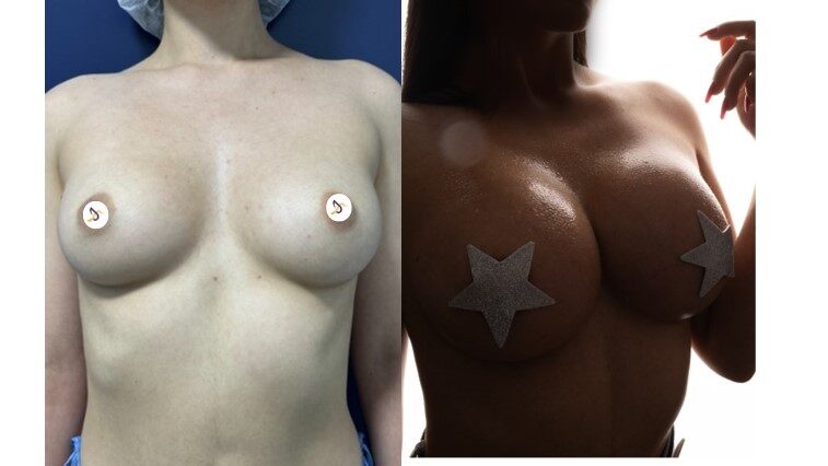 corporal